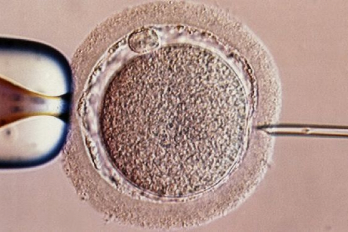 Nació en la Argentina el primer bebé con el método de fertilidad de “tres padres” 